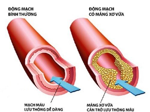 Liệu tác dụng của hoa tam thất có thực sự tốt no